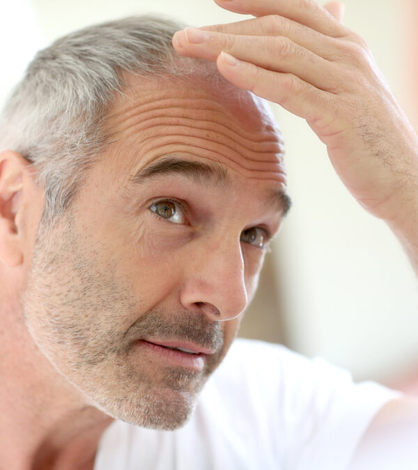 Hair Loss